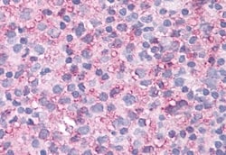 Invitrogen NEK6 Polyclonal Antibody 50 μg; Unconjugated:Antibodies,