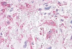 Invitrogen NEK6 Polyclonal Antibody 50 μg; Unconjugated:Antibodies,