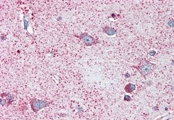 Invitrogen NEK6 Polyclonal Antibody 50 μg; Unconjugated:Antibodies,