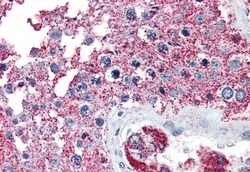 Invitrogen NEK6 Polyclonal Antibody 50 μg; Unconjugated:Antibodies,