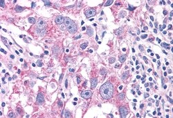 Invitrogen NEK6 Polyclonal Antibody 50 μg; Unconjugated:Antibodies,