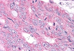 Invitrogen NEK6 Polyclonal Antibody 50 μg; Unconjugated:Antibodies,