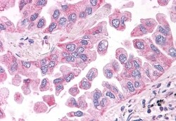 Invitrogen NEK6 Polyclonal Antibody 50 μg; Unconjugated:Antibodies,