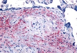 Invitrogen NET1 Polyclonal Antibody 50 &mu;g; Unconjugated:Antibodies,