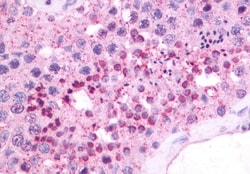 Invitrogen NMBR Polyclonal Antibody 50 &mu;g; Unconjugated:Antibodies,