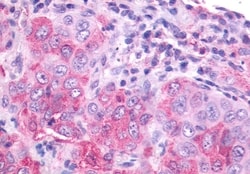 Invitrogen NMBR Polyclonal Antibody 50 &mu;g; Unconjugated:Antibodies,
