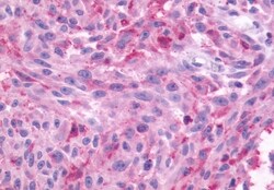 Invitrogen NMBR Polyclonal Antibody 50 &mu;g; Unconjugated:Antibodies,
