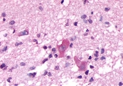 Invitrogen NMBR Polyclonal Antibody 50 &mu;g; Unconjugated:Antibodies,