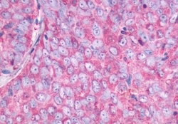 Invitrogen NMBR Polyclonal Antibody 50 &mu;g | Buy Online | Invitrogen&trade; | Fisher Scientific