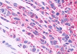 Invitrogen NMBR Polyclonal Antibody 50 &mu;g | Buy Online | Invitrogen&trade; | Fisher Scientific