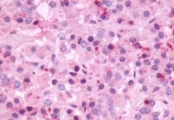 Invitrogen NMBR Polyclonal Antibody 50 &mu;g | Buy Online | Invitrogen&trade; | Fisher Scientific