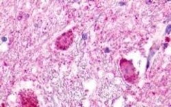 Invitrogen NMUR1 Polyclonal Antibody 50 &mu;g | Buy Online | Invitrogen&trade; | Fisher Scientific