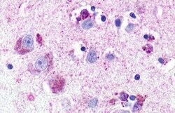 Invitrogen NMUR1 Polyclonal Antibody 50 &mu;g | Buy Online | Invitrogen&trade; | Fisher Scientific