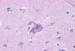 Invitrogen NPY5R Polyclonal Antibody 50 &mu;g; Unconjugated:Antibodies,