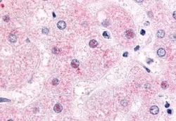Invitrogen NR0B2 Polyclonal Antibody 50 μg; Unconjugated:Antibodies,