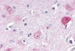 Invitrogen NR1D1 Polyclonal Antibody 50 &mu;g | Buy Online | Invitrogen&trade; | Fisher Scientific