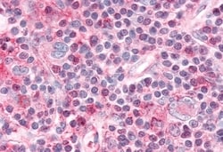 Invitrogen NR1D1 Polyclonal Antibody 50 &mu;g | Buy Online | Invitrogen&trade; | Fisher Scientific