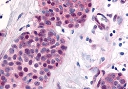 Invitrogen TLX Polyclonal Antibody 50 &mu;g; Unconjugated:Anticuerpos