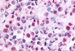 Invitrogen EAR2 Polyclonal Antibody 50 &mu;g | Buy Online | Invitrogen&trade; | Fisher Scientific