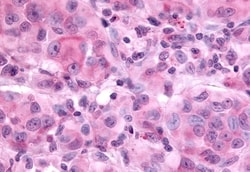 Invitrogen EAR2 Polyclonal Antibody 50 &mu;g; Unconjugated:Antibodies,