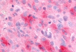 Invitrogen EAR2 Polyclonal Antibody 50 &mu;g; Unconjugated:Antibodies,