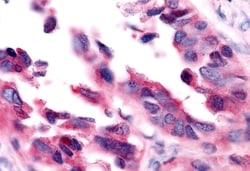 Invitrogen EAR2 Polyclonal Antibody 50 &mu;g; Unconjugated:Antibodies,