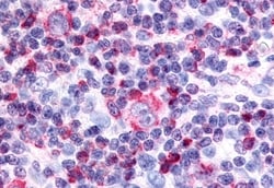 Invitrogen NOR-1 Polyclonal Antibody 50 &mu;g; Unconjugated:Antibodies,