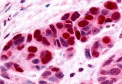 Invitrogen NOR-1 Polyclonal Antibody 50 &mu;g; Unconjugated:Antibodies,