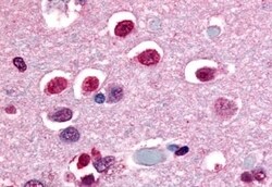 Invitrogen NOR-1 Polyclonal Antibody 50 &mu;g; Unconjugated:Antibodies,