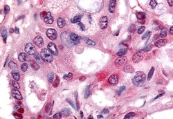 Invitrogen NOR-1 Polyclonal Antibody 50 &mu;g; Unconjugated:Antibodies,