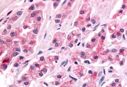 Invitrogen NOR-1 Polyclonal Antibody 50 &mu;g; Unconjugated:Antibodies,