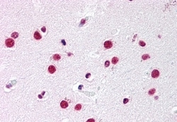 Invitrogen NR5A1 Polyclonal Antibody 50 &mu;g; Unconjugated:Antibodies,