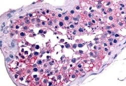 Invitrogen GCNF Polyclonal Antibody 50 &mu;g | Buy Online | Invitrogen&trade; | Fisher Scientific