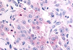 Invitrogen GCNF Polyclonal Antibody 50 &mu;g | Buy Online | Invitrogen&trade; | Fisher Scientific