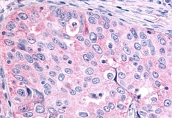 Invitrogen GCNF Polyclonal Antibody 50 &mu;g | Buy Online | Invitrogen&trade; | Fisher Scientific