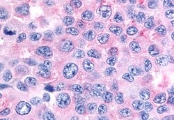 Invitrogen GCNF Polyclonal Antibody 50 &mu;g | Buy Online | Invitrogen&trade; | Fisher Scientific