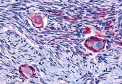Invitrogen NR4A1 Polyclonal Antibody 50 &mu;g; Unconjugated:Antibodies,