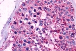 Invitrogen Opsin 5 Polyclonal Antibody 50 &mu;g; Unconjugated:Antibodies,