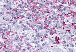 Invitrogen OPRM1 Polyclonal Antibody 50 μg; Unconjugated:Antibodies,