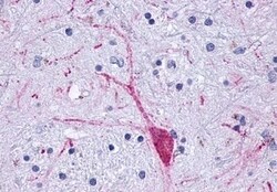 Invitrogen OPRM1 Polyclonal Antibody 50 μg; Unconjugated:Antibodies,