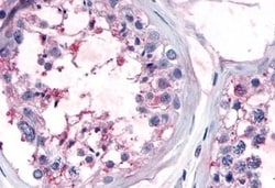 Invitrogen OR10R2 Polyclonal Antibody 50 &mu;g; Unconjugated:Antibodies,