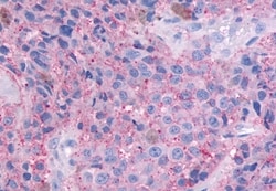 Invitrogen OR51E1 Polyclonal Antibody 50 &mu;g; Unconjugated:Antibodies,