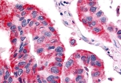 Invitrogen OR6N1 Polyclonal Antibody 50 &mu;g | Buy Online | Invitrogen&trade; | Fisher Scientific