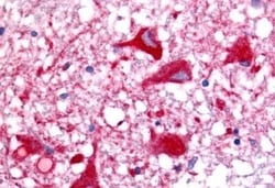 Invitrogen OR6N1 Polyclonal Antibody 50 &mu;g | Buy Online | Invitrogen&trade; | Fisher Scientific