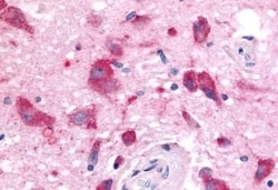 Invitrogen OR6N1 Polyclonal Antibody 50 &mu;g | Buy Online | Invitrogen&trade; | Fisher Scientific