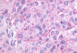 Invitrogen OXER1 Polyclonal Antibody 50 &mu;g | Buy Online | Invitrogen&trade; | Fisher Scientific