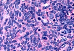 Invitrogen Oxytocin Receptor Polyclonal Antibody 50 &mu;g; Unconjugated:Antibodies,