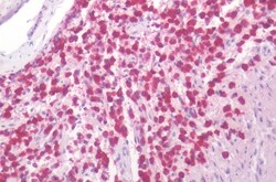 Invitrogen Oxytocin Receptor Polyclonal Antibody 50 &mu;g; Unconjugated:Antibodies,