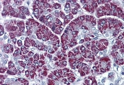 Invitrogen P2X3 Polyclonal Antibody 50 &mu;g; Unconjugated:Antibodies,