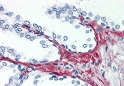 Invitrogen P2X3 Polyclonal Antibody 50 &mu;g; Unconjugated:Antibodies,